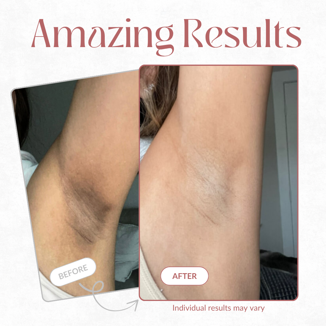 Body Peel Spray - Kojic + Gurkemeje
