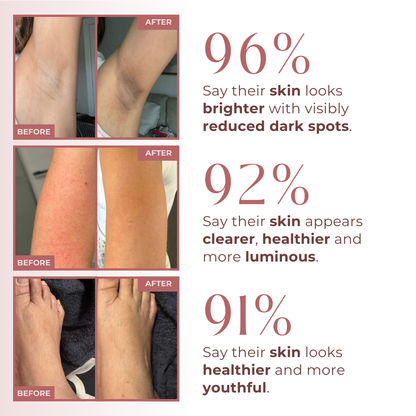 Body Peel Spray - Kojic + Gurkemeje